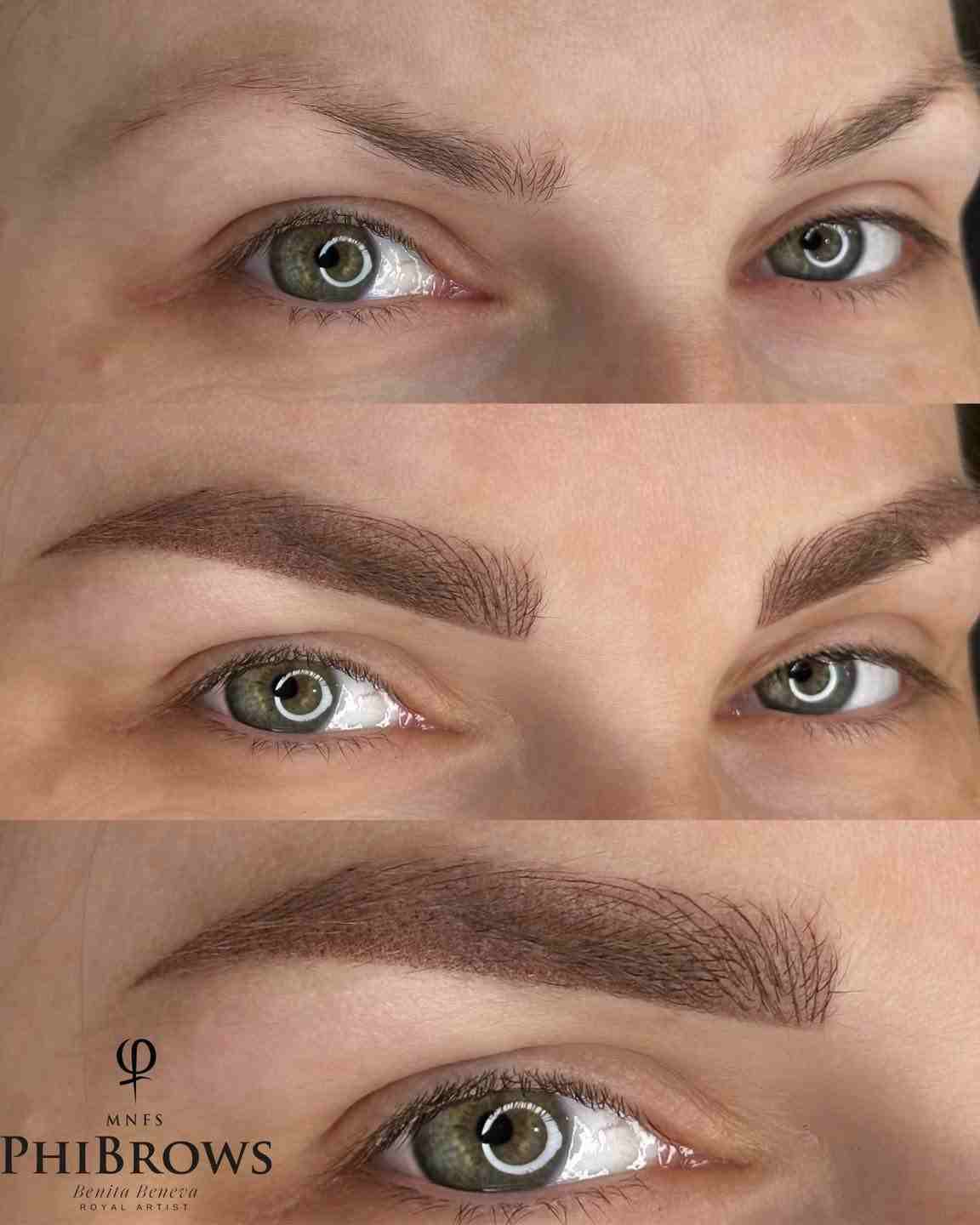 Клиентски резултат след процедура